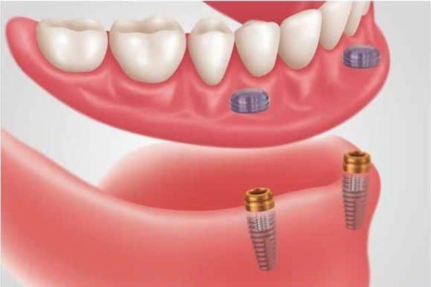 geriatric dentistry