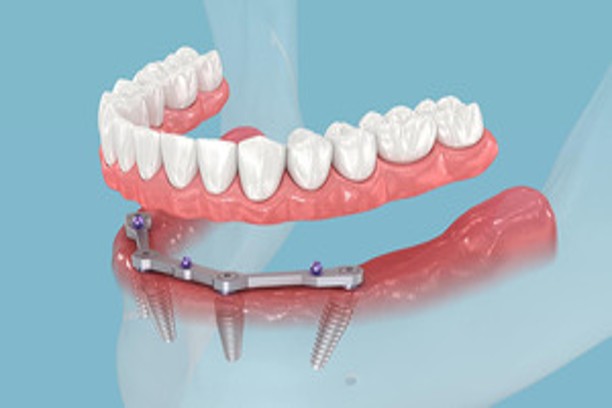 geriatric dental care coimbatore